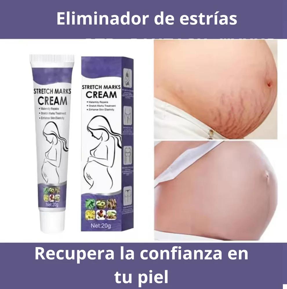 eliminador de estrias
